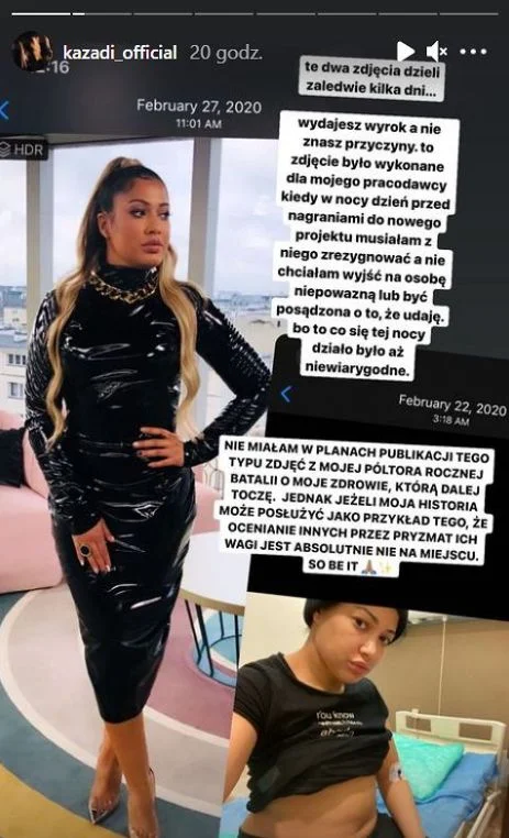 Kazadi o body shamingu.