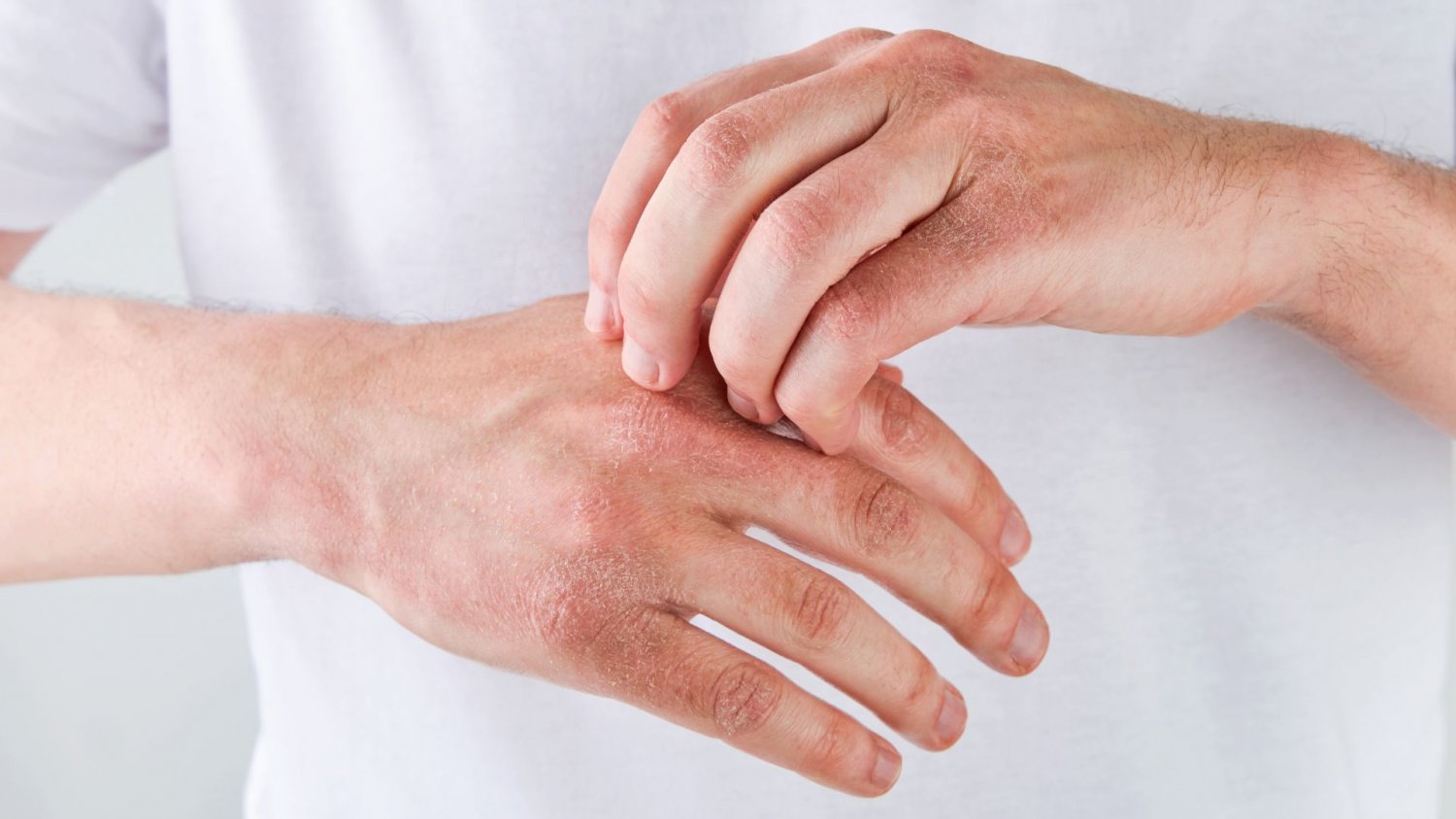 Sposoby na suche ręce zimą. Wybrałam dla was te, które testowałam i działają