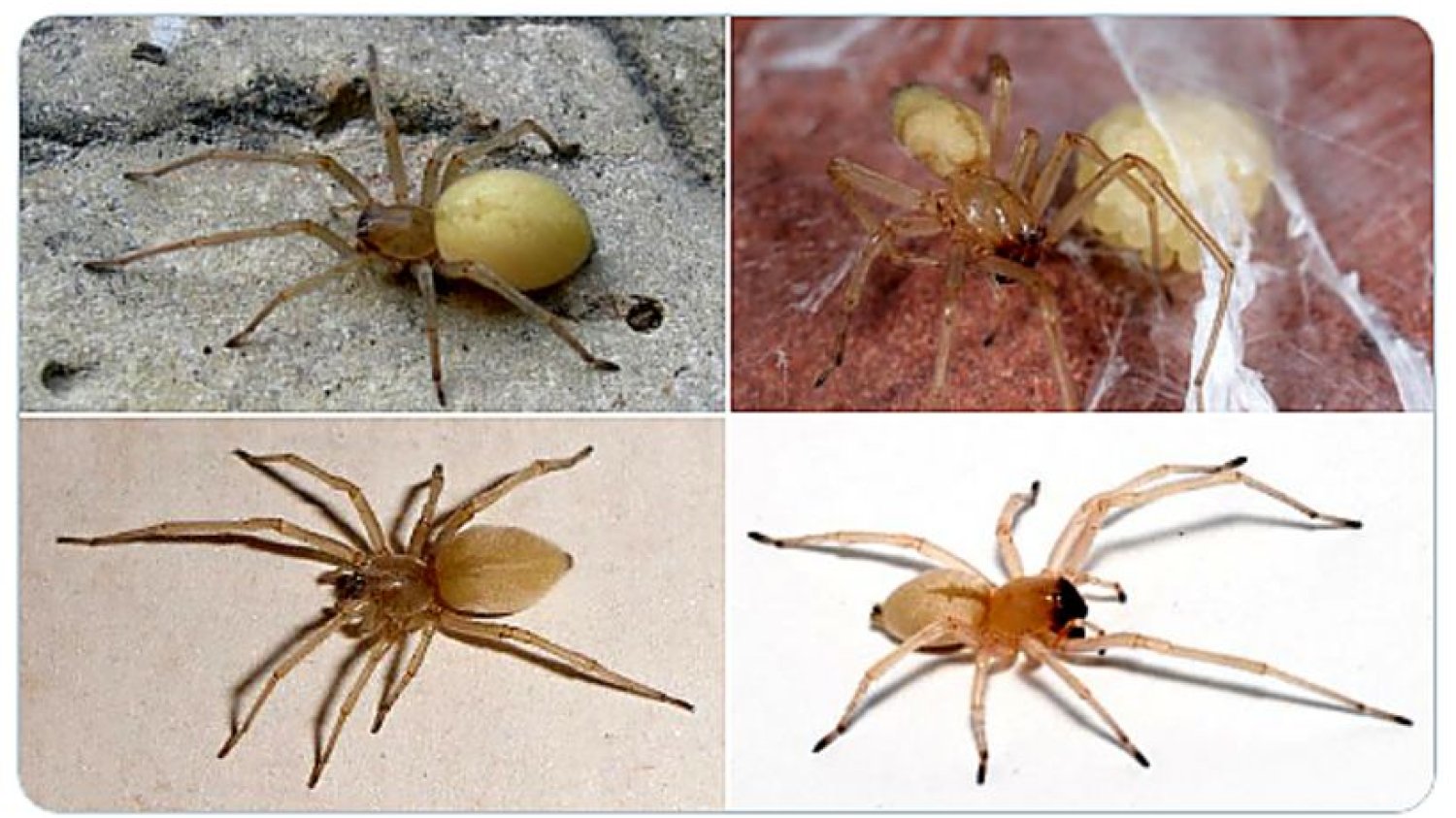 Kolczak zbrojny (Cheiracanthium punctorium) jest jednym z najbardziej jadowitych pająków w Polsce. Jego ukąszenie może powodować nawet 2-tygodniowe zatrucie całego organizmu. Kolczak zbrojny: objawy ukąszenia jadowitego pająka (Cheiracanthium punctorium), który grasuje w lasach