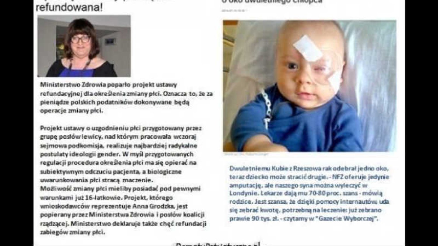 Prawica straszy, że rząd chce refundować operacje zmiany płci.