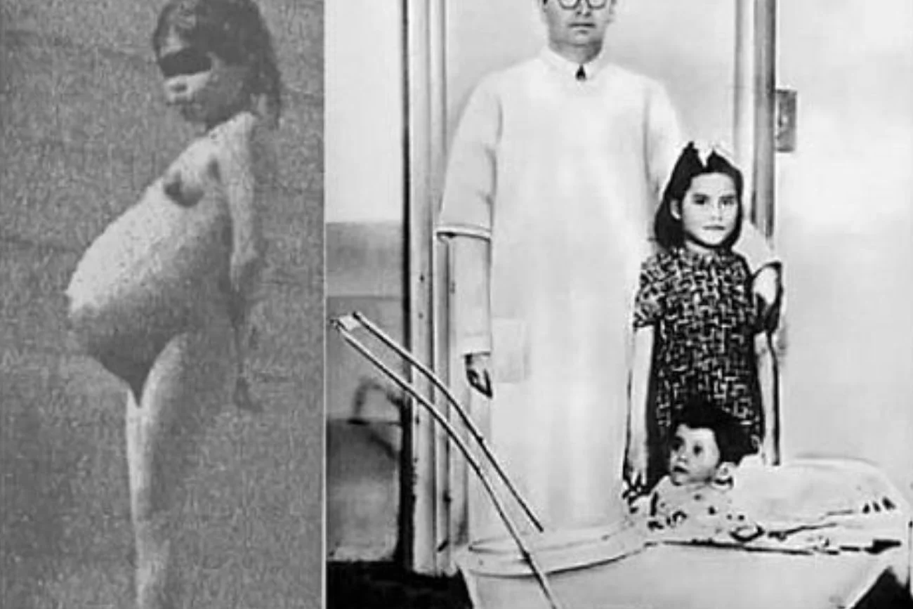 Lina Medina Lina Medina