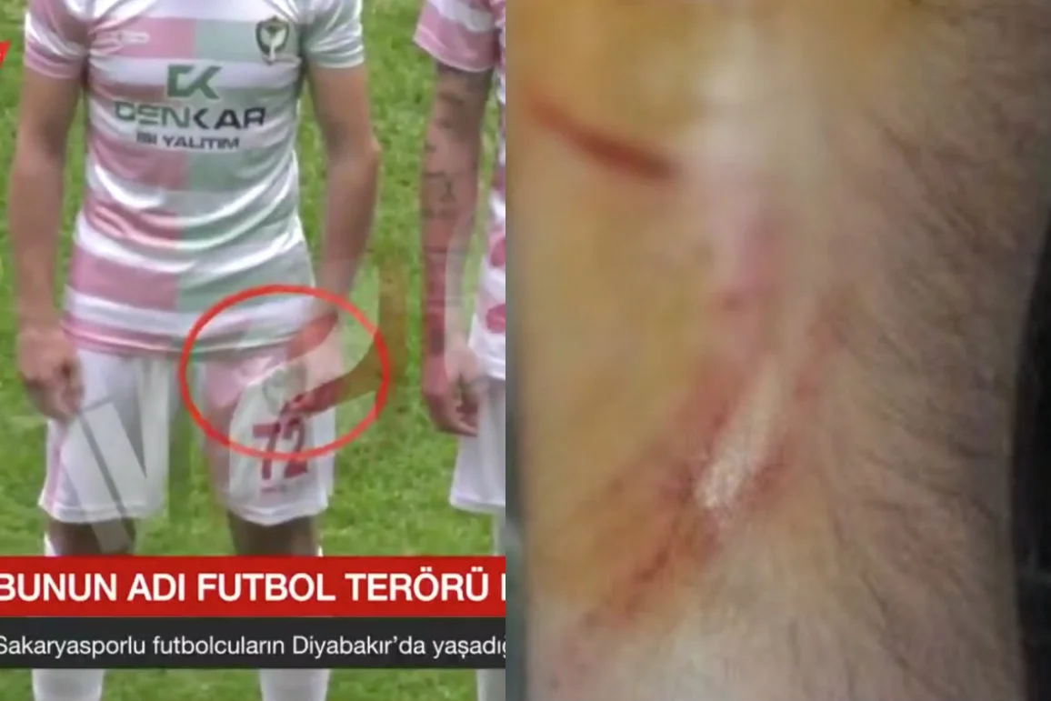 Zawodnik kurdyjskiego klubu Amed zaatakował kilku piłkarzy żyletką.