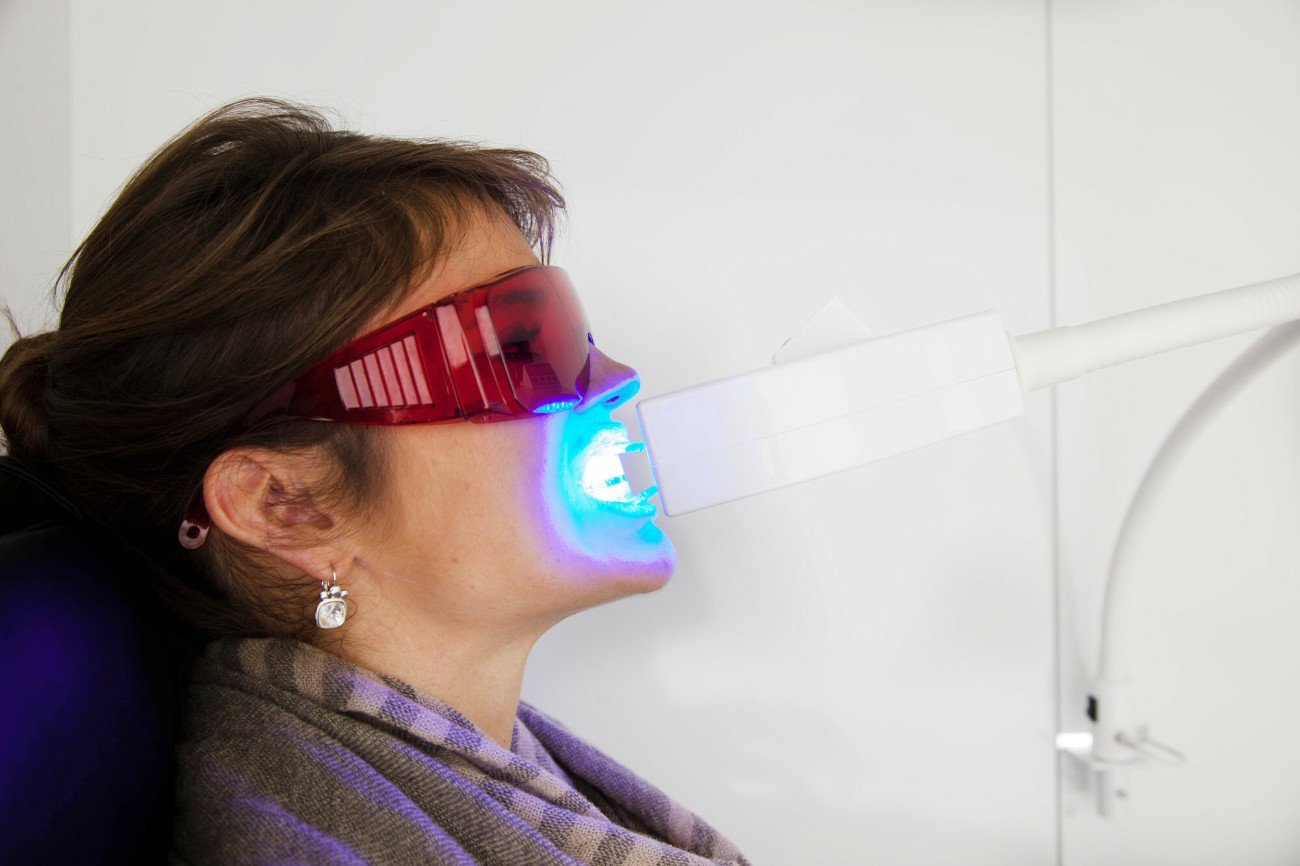 W pogoni za białym uśmiechem jesteśmy gotowi sięgnąć po różne metody. Nie tylko te sprawdzone i bezpieczne.