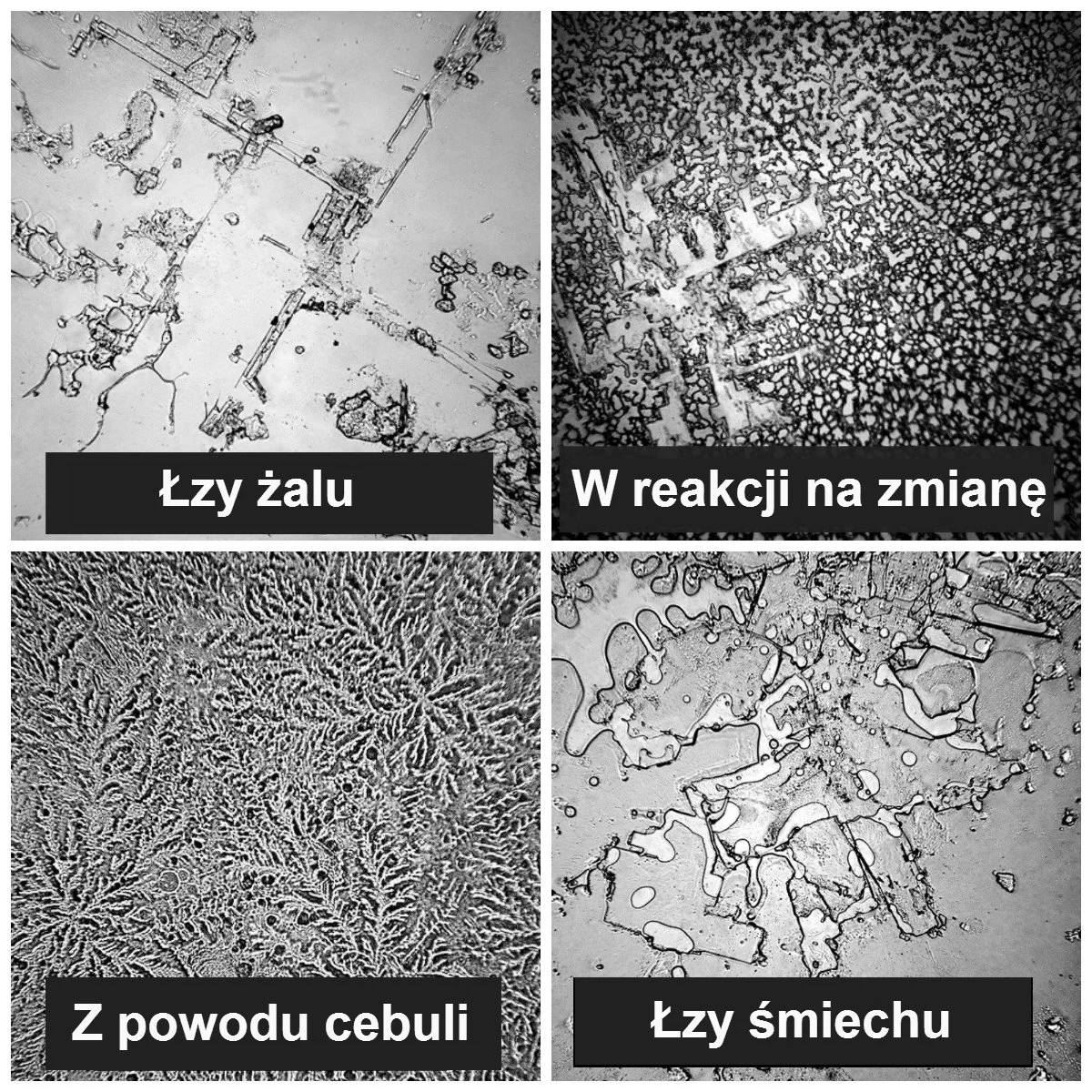 Rodzaje łez pod mikroskopem