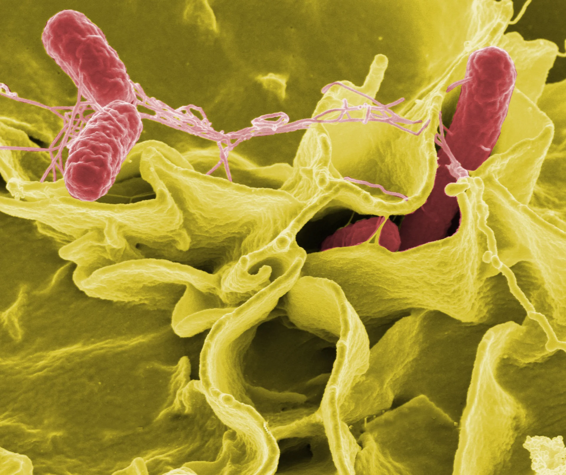 Bakterie potrafią być ładne. Na rysunku bakterie Salmonella (różowe) na ludzkich tkankach (żółtych).