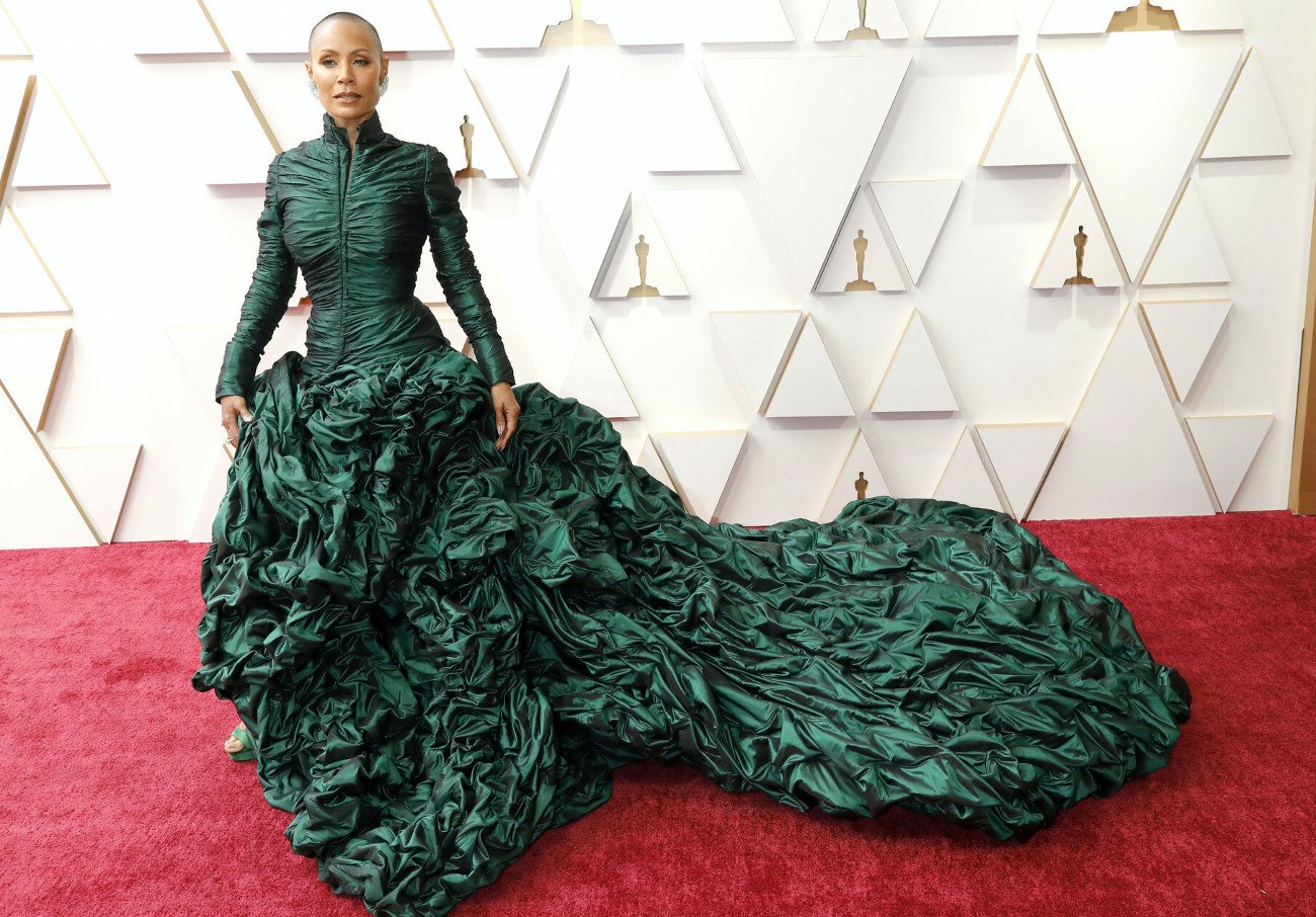 Jada Pinkett Smith choruje na łysienie plackowate.