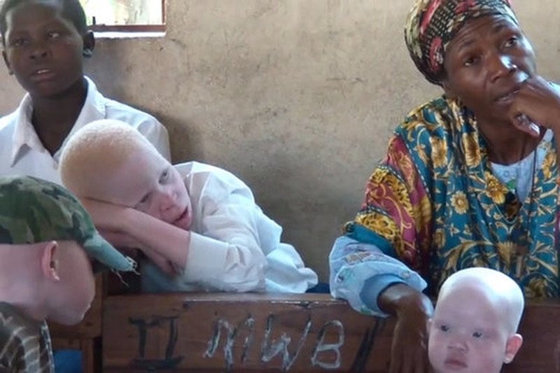 Z danych lokalnych aktywistów wynika, że od 2000 roku w Tanzanii z powodu przesądów zamordowano ok. 70 albinosów.