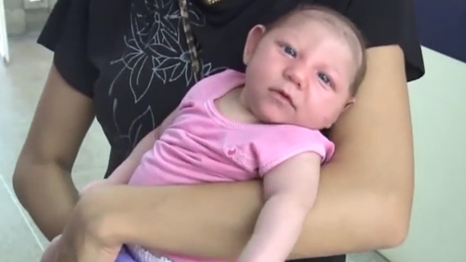 Wirus Zika powoduje małogłowie u dzieci matek, które podczas ciąży uległy zakażeniu.