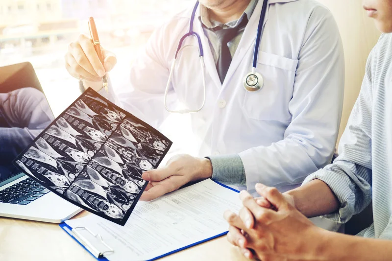 Tylko 5 proc. chorych na drobnokomórkowego raka płuca przeżywa 5 lat od diagnozy.