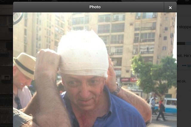 Dziennikarz BBC Jeremy Bowen zaraz po tym, jak został postrzelony w Kairze