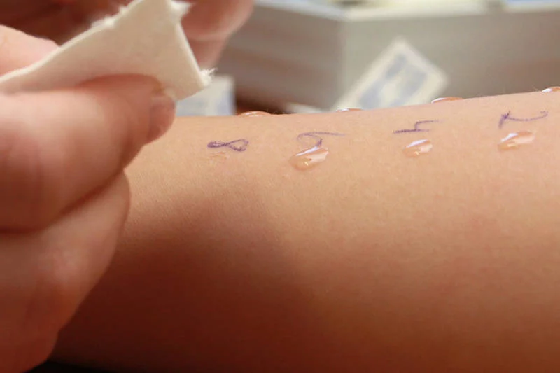 Testy alergiczne sprawdza się po 24 i 48 godzinach. Często alergia kontaktowa pojawia się dopiero po dwóch dobach, dlatego tak ciężko ją samemu wychwicić