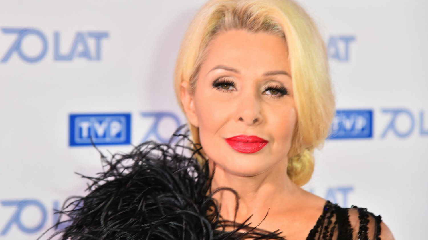 Aldona Orman na Instagramie dodała zdjęcie swojego tętniaka. Jak się czuje?