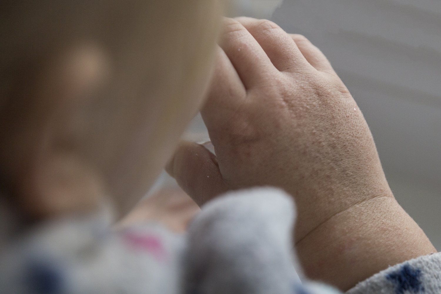 Szkarlatyna wbrew pozorom doprowadziła w Wielkiej Brytanii do większej liczby zachorowań niż covid-19.