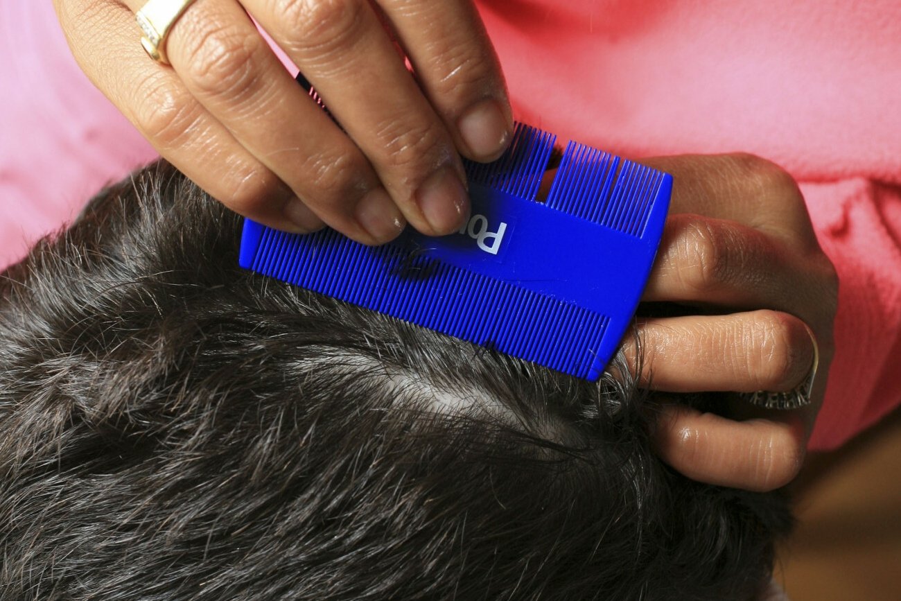 Wszawica jest postrzegana jako tabu w społeczeństwie, przez co szybciej się rozprzestrzenia