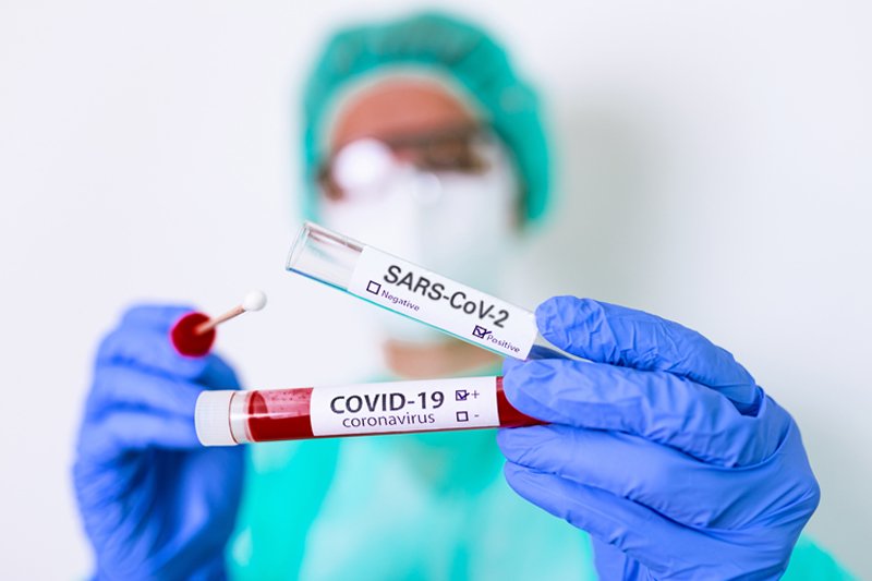 Jakie testy służą do diagnostyki zakażeń SARS-CoV-2? Jak znaleźć renomowane laboratorium? Pomoże w tym pierwsza w Polsce wyszukiwarka laboratoriów diagnostycznych CoV-2.pl uruchomiona przez firmę EUROIMMUN