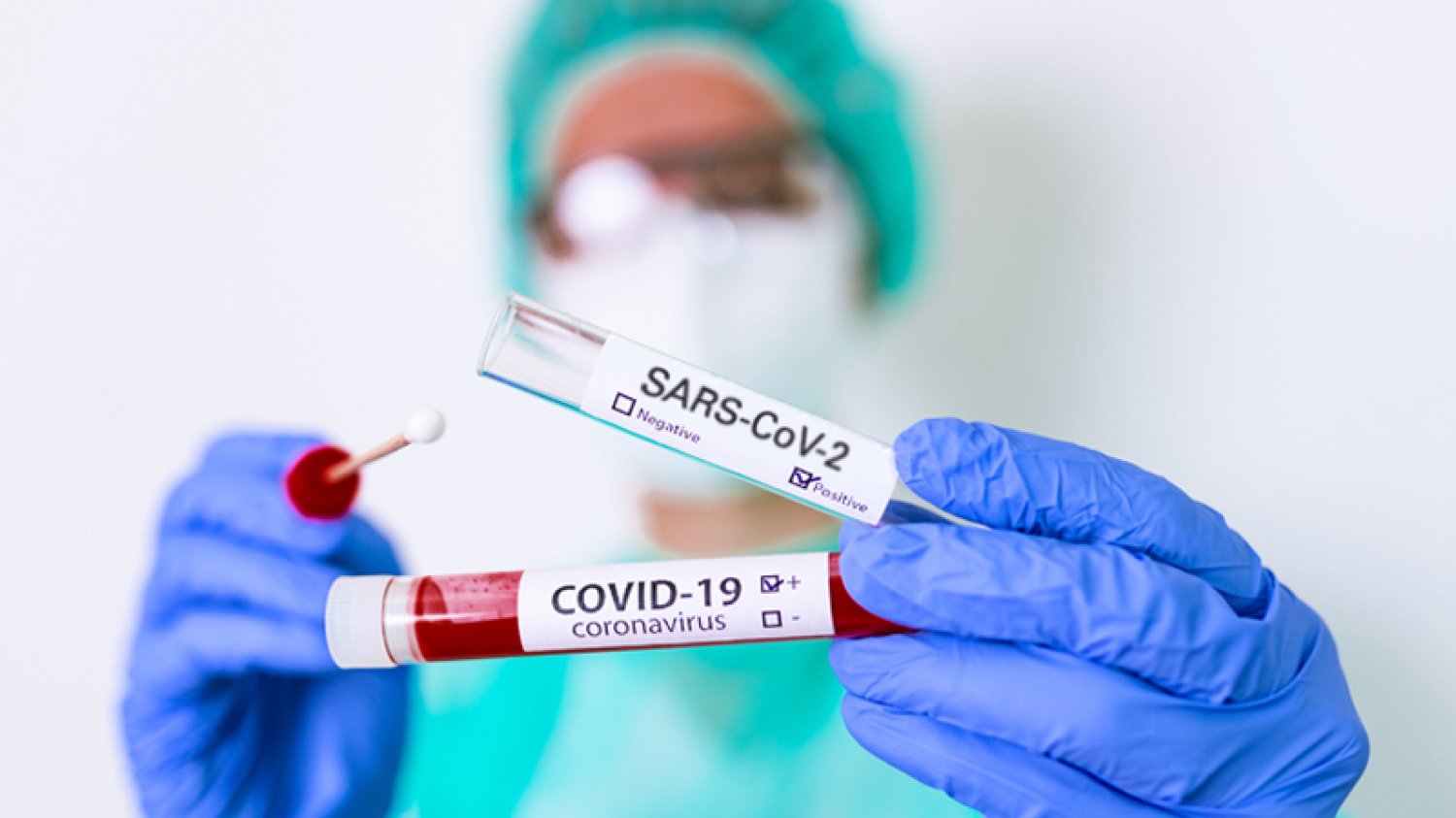 Jakie testy służą do diagnostyki zakażeń SARS-CoV-2? Jak znaleźć renomowane laboratorium? Pomoże w tym pierwsza w Polsce wyszukiwarka laboratoriów diagnostycznych CoV-2.pl uruchomiona przez firmę EUROIMMUN