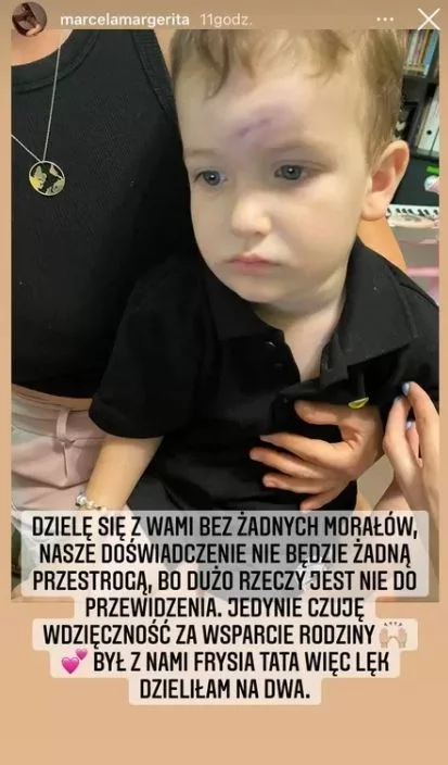 Wypadek w przedszkolu małego Fryderyka.