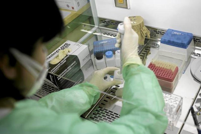 W USA zdiagnozowano pierwszy przypadek wirusa ebola poza Afryką