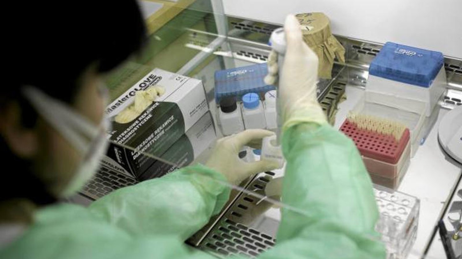 W USA zdiagnozowano pierwszy przypadek wirusa ebola poza Afryką