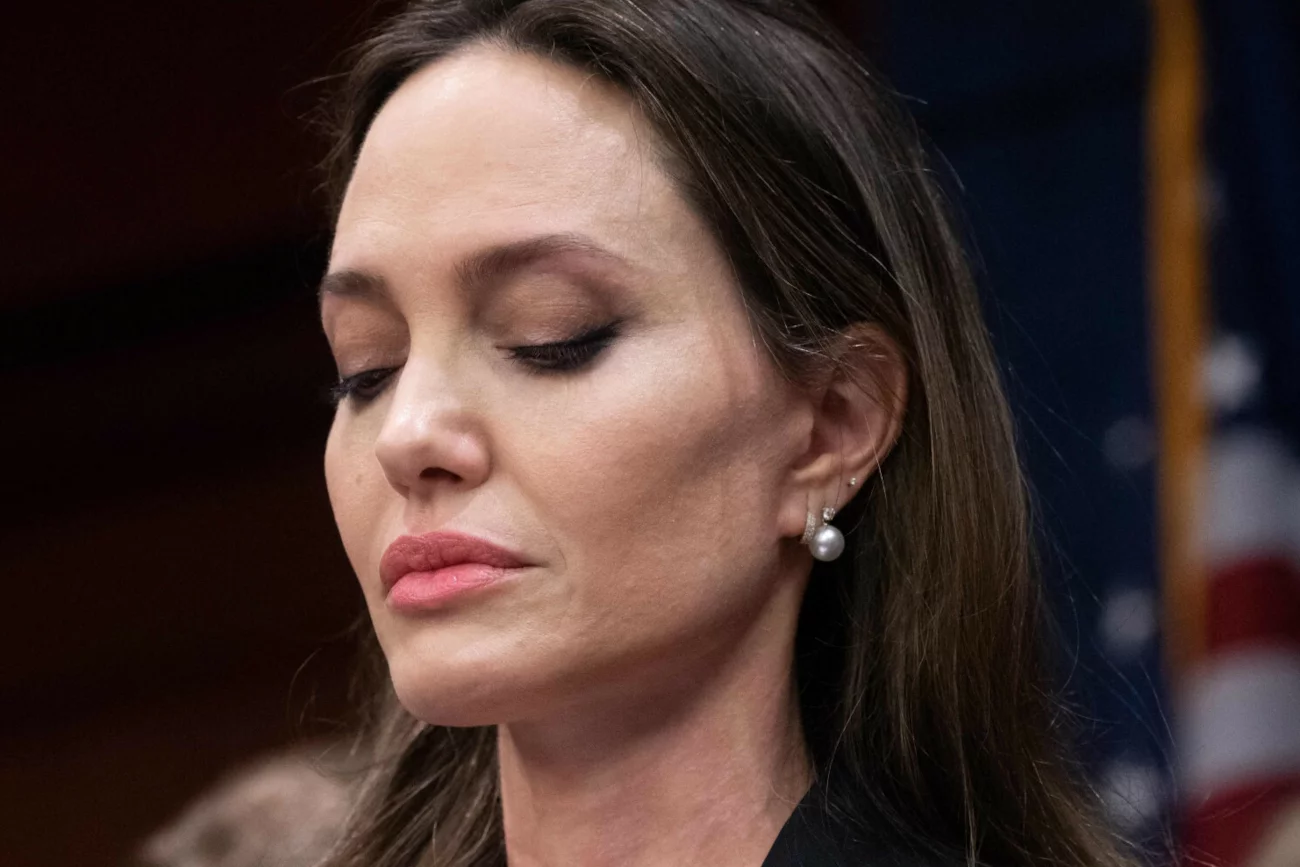 Angelina Jolie pokazała zdjęcia siniaków, które miał jej nabić Brad Pitt.