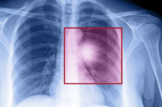 Prof. David Taylor z University College London liczy na przełom w walce z nowotworami