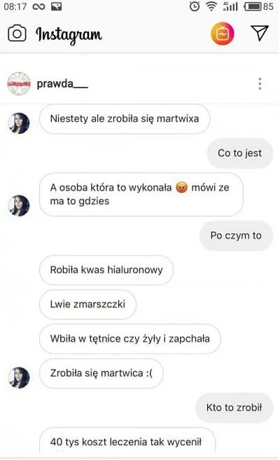 Martwica twarzy brzmi przerażająco.