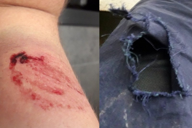 Strażnik miejski został pogryziony w Warszawie.