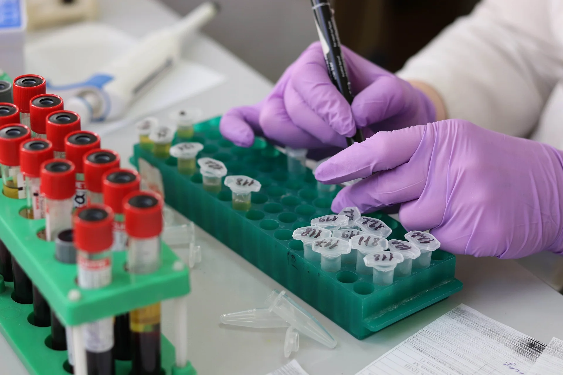 Badania wykonuje się u osób, które mogły zostać zakażone HCV np. przez kontakt z zakażoną krwią, u pacjentów z grup ryzyka zakażenia HCV oraz tych, którzy mają objawy świadczące o chorobie wątroby