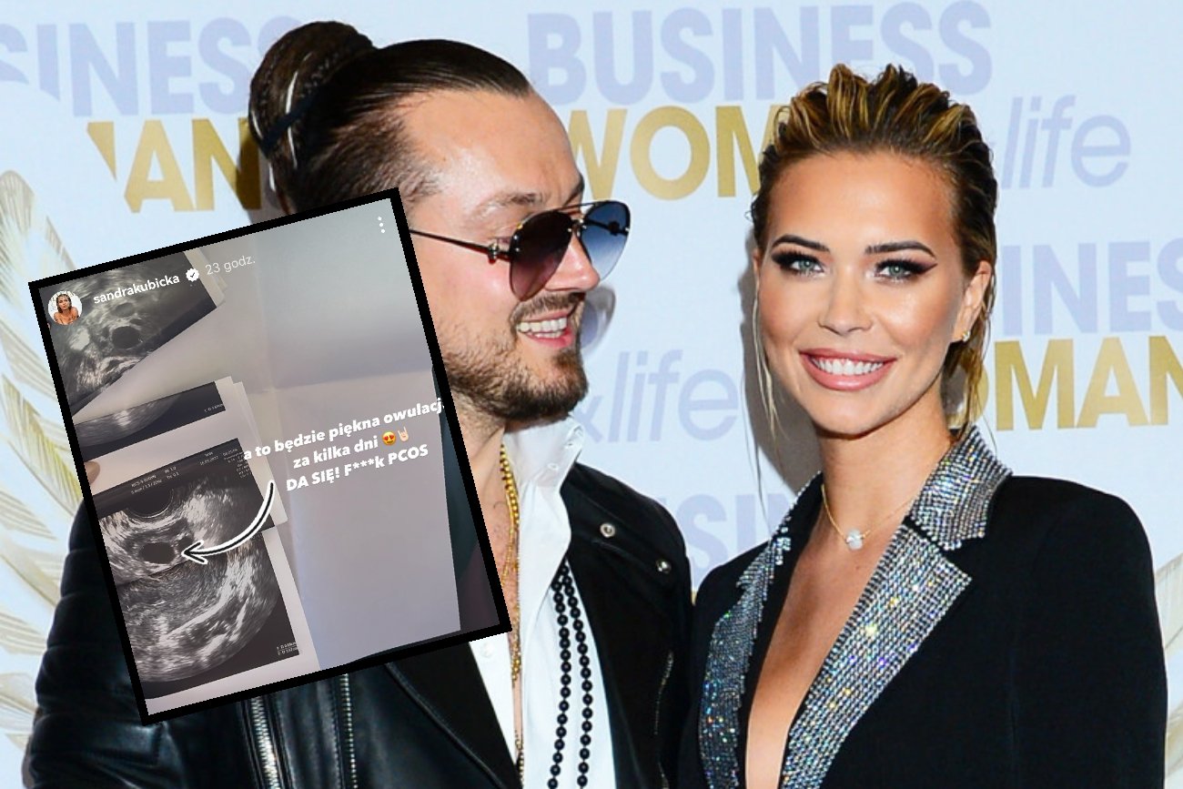 Sandra Kubicka wcale nie rozstała się z Baronem. Wrzuciła zdjęcie USG