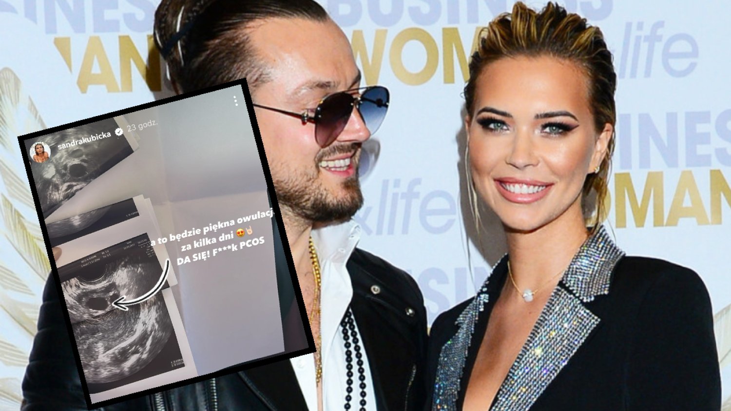 Sandra Kubicka wcale nie rozstała się z Baronem. Wrzuciła zdjęcie USG