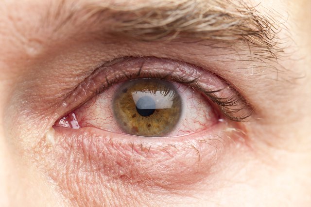 Nie wiadomo czy brak snu może prowadzić do śmierci