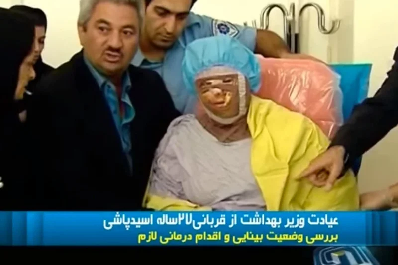 Nieznani sprawcy oblewają Iranki kwasem. Śledztwo nie przynosi skutku, kobiety wychodzą na ulice