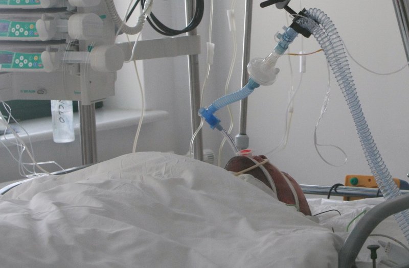 Głupi żart skończył się podpaleniem (zdjęcie jest tylko ilustracją do tekstu)