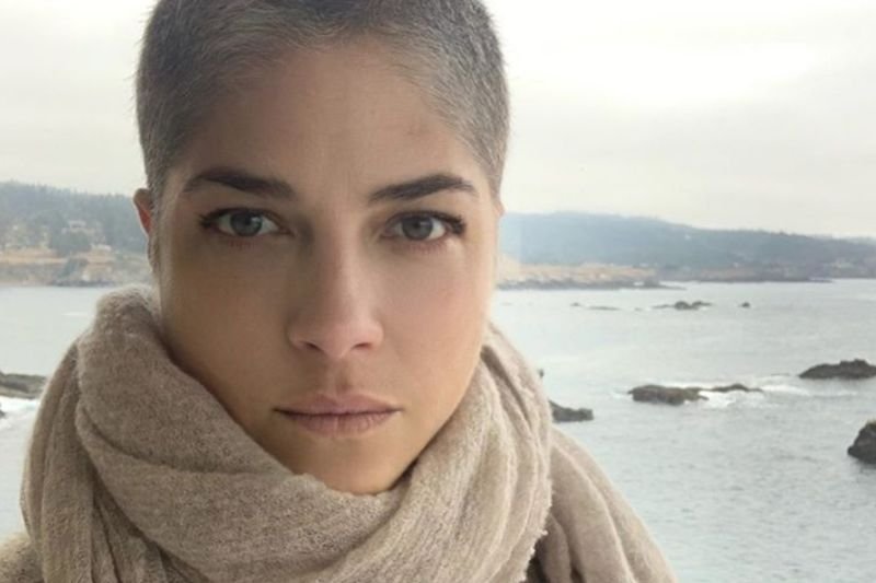 Aktorka cierpi na stwardnienie rozsiane.