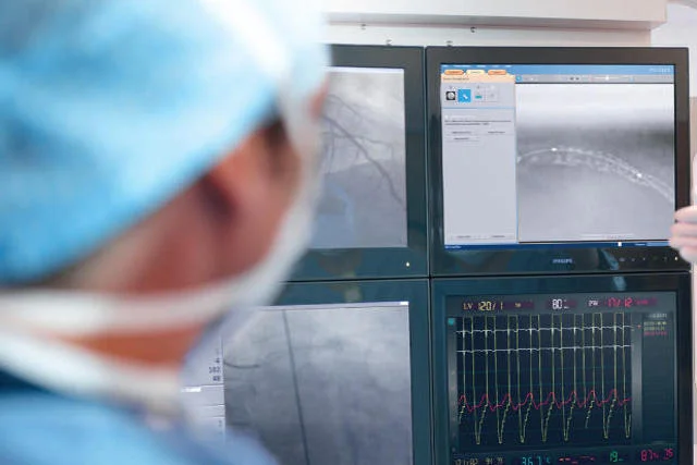 System sercowo-naczyniowy AlluraClarity pozwala na obniżenie dawki promieniowania o 50-75% bez obniżania jakości obrazu diagnostycznego.