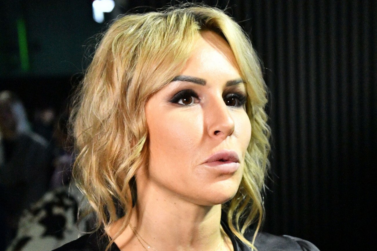 Blanka Lipińska też ma niedoskonałości na swojej twarzy.