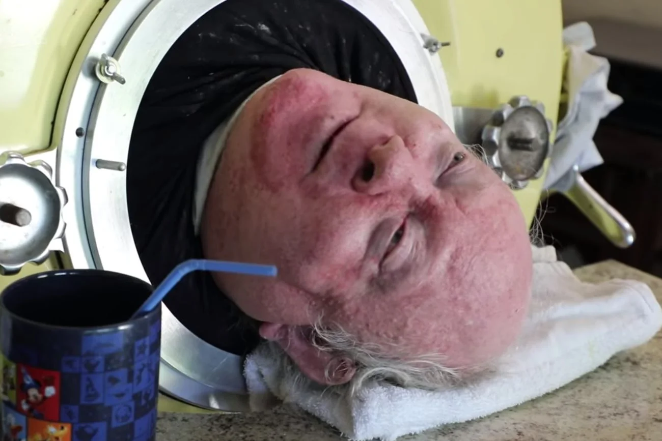 Paul Alexander w żelaznym płucu. Paul Alexander w żelaznym płucu.