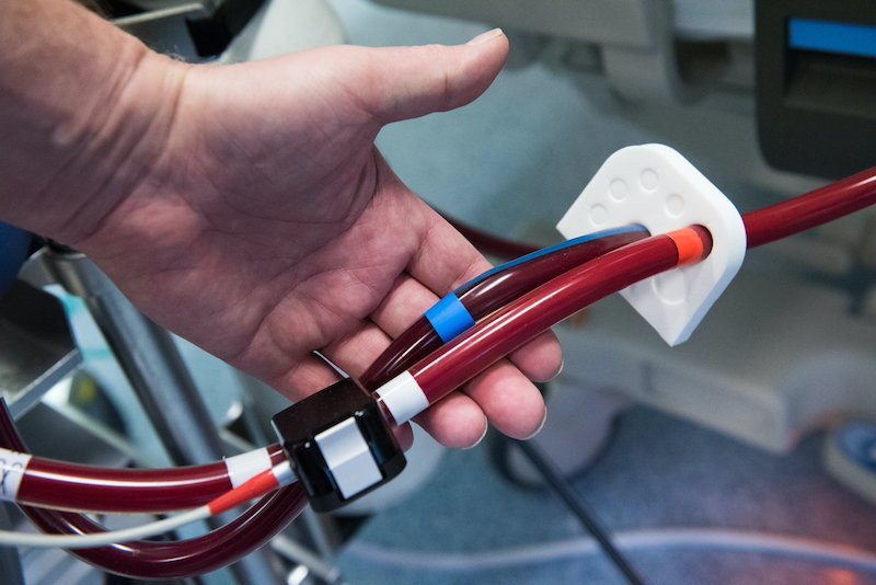 Uniwersytecki Szpital Kliniczny przy ulicy Borowskiej 213 we Wrocławiu (17.02.2021). Oddział intensywnej terapii, pacjent podłączony do ECMO (pozaustrojowe utlenowanie krwi).