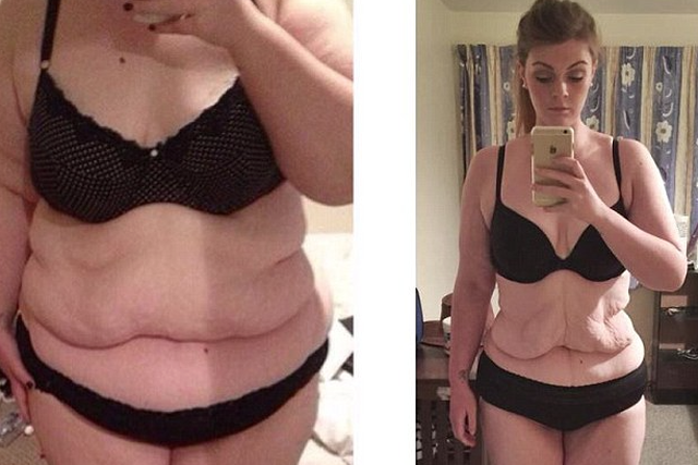 Odchudzanie nie jest piękne