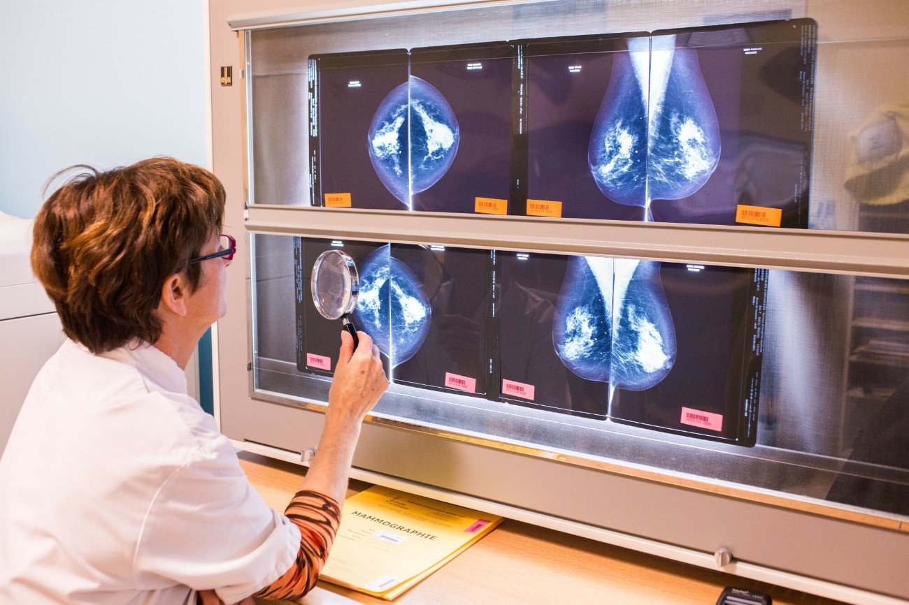 Onkologia jest kobietą? Rak piersi to najczęściej diagnozowany nowotwór, ale udaje się go coraz skuteczniej leczyć