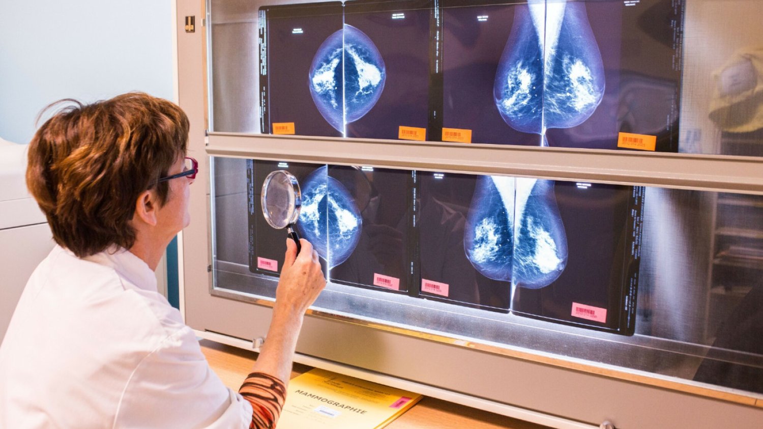 Onkologia jest kobietą? Rak piersi to najczęściej diagnozowany nowotwór, ale udaje się go coraz skuteczniej leczyć