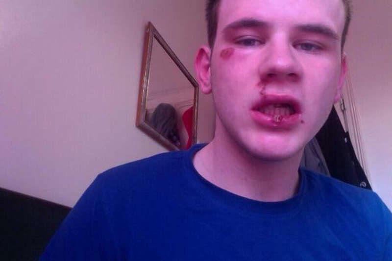 Richard Kennedy ogłosił, że został pobity z powodu bycia gejem. Okazało się, że kłamał