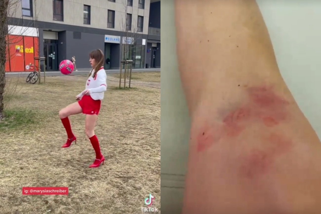 Marianna Schreiber żonglowała piłką w szpilkach. Musiała jechać do szpitala