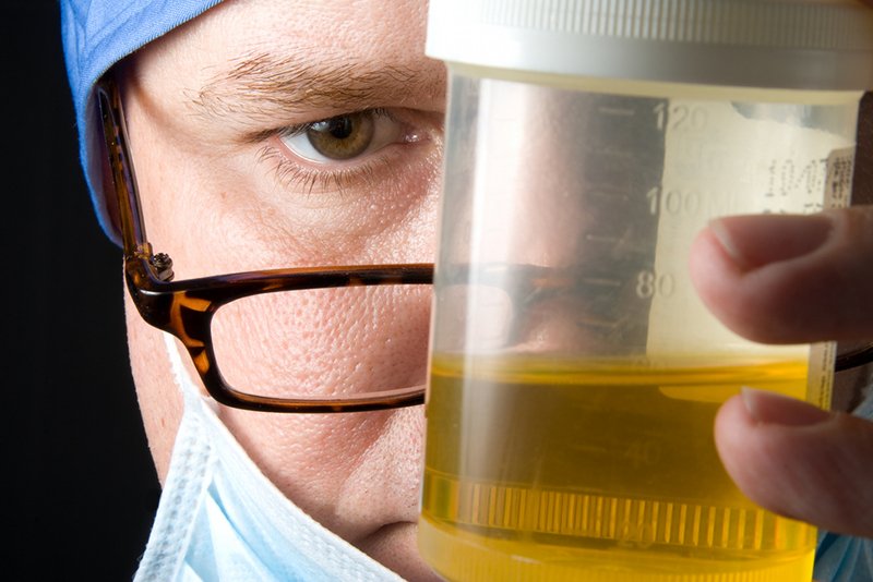 "Złota fontanna" to książka o urynoterapii.