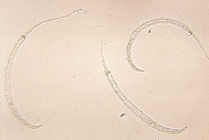 Larwa pasożyta z gatunku Dracunculus medinensis