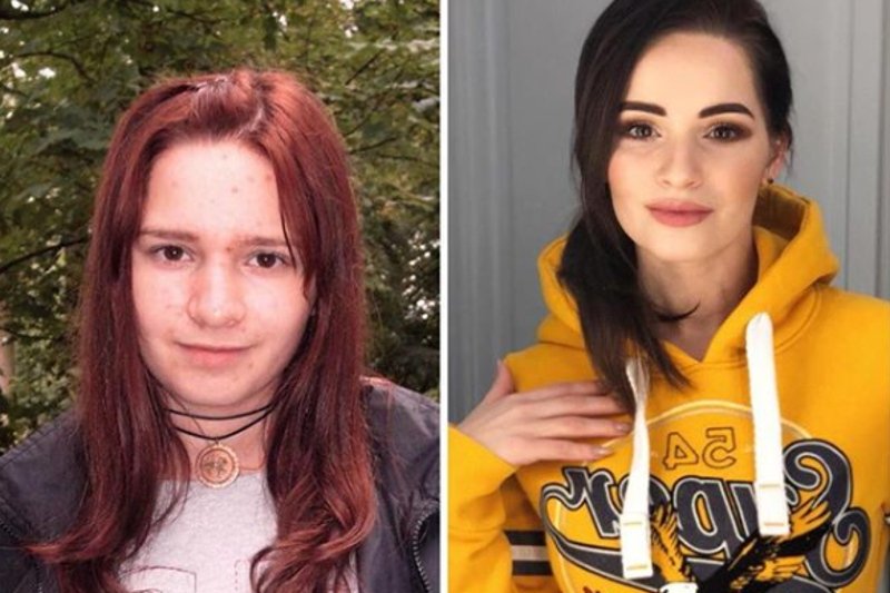 Ewelina Lisowska przyznała, że powiększyła sobie usta.