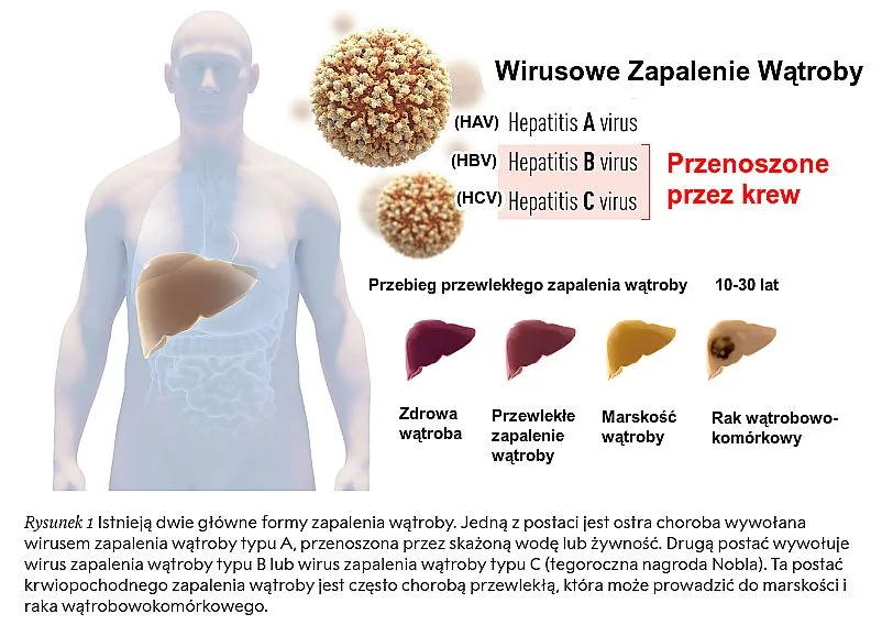 Typy wirusów prowadzących do WZW. Nagroda Nobla z medycyny 2020.