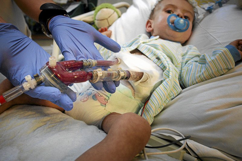 Dziecko oczekuje na przeszczep