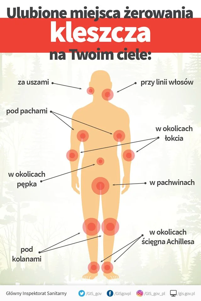 Kleszcze na ciele człowieka. Które miejsca najczęściej atakują?