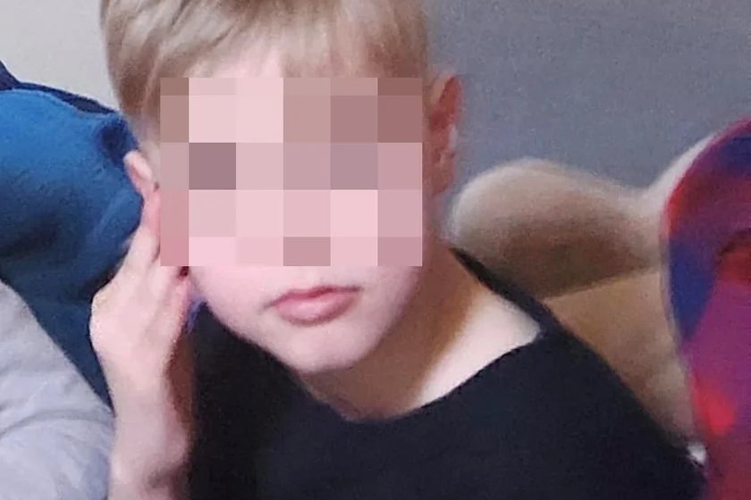 Kamilek z Częstochowy poparzenia miał na 25 proc. ciała. Opinia lekarza Kamilek z Częstochowy poparzenia miał na 25 proc. ciała. Opinia lekarza